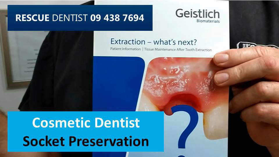 Cosmetic dentistry Socket Preservation